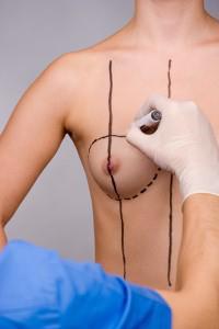 Traços precisos para cada tipo de mulher são analisados pelo cirurgião