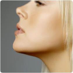 Também conhecida como lipoaspiração da ‘papada’, é indicada para restabelecer e diminuir a flacidez da estrutura da face