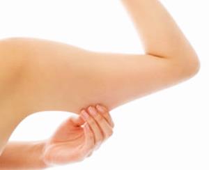 Lifting de Braços é indicado para quem quer diminuir a flacidez e excesso de pele nesta região do corpo